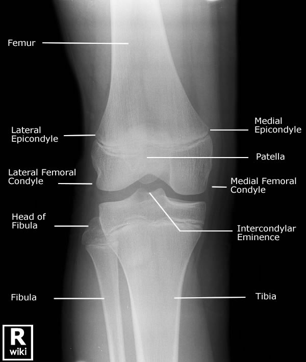 knee-x-ray-ap.jpeg
